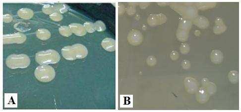 13 pela bactéria Xanthomonas campestris pv. viticola Nayudu (Dye) (MALAVOLTA JR. et al., 1999a; LIMA et al., 1999). Foram coletadas amostras da variedade Red Globe (V.