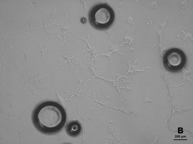 celular (figura 2). Figura 2: Cultivo das células endoteliais de rato Lewis. Na figura A possuímos ECs cultivados em meio MCDB com 5% de SFB.
