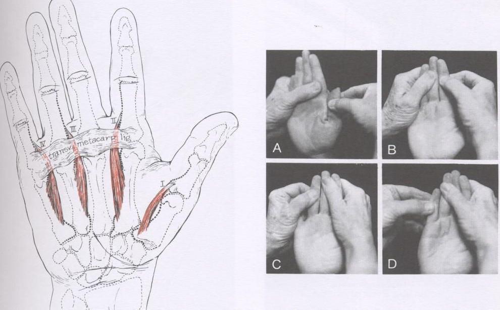 11 Músculo Extensor Curto do Polegar Inserção Proximal: Face posterior do rádio e membrana interóssea. Inserção Distal: Face dorsal da falange proximal do polegar.