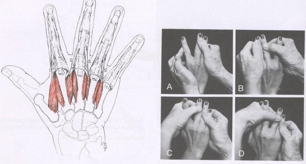 5 - Sistema Vascular Conforme relatado na descrição anatômica do cotovelo, a vascularização do membro superior é feita pela artéria braquial que ao cruzar a articulação do