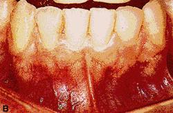 Ao circundar toda a rima da boca, esse músculo se apresenta como uma elipse situada na espessura dos lábios, mais próxima do plano mucoso do que do cutâneo.
