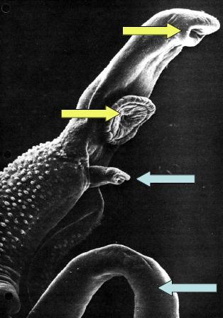 Vermes adultos Características 2 ventosas (oral e ventral) Estrutura de fixação Tegumento