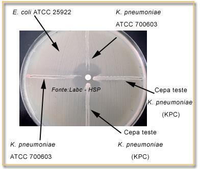 Para as amostras nas quais o teste de triagem for positivo para produção de KPC, pode ser realizado o Teste de Hodge.