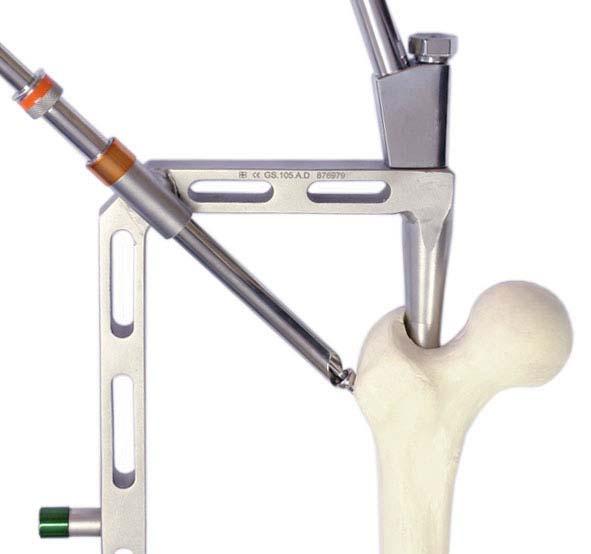 27 Importante: instrumentais identificados com a cor laranja para facilitar a utilização. GS.101.A GS.