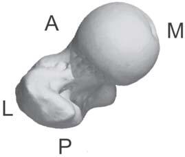 2. Acesso Realiza-se uma incisão que deverá iniciar-se 2cm distal a ponta do grande trocanter e extender-se 6 a 8 cm proximal.