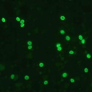 B- Oocistos de Cryptosporidium spp.