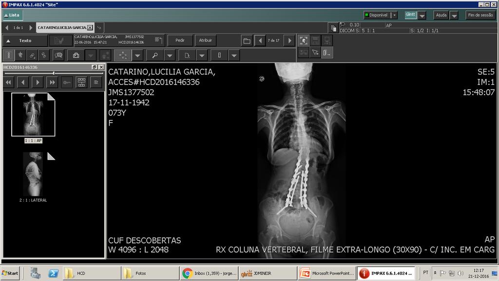 A B C Imagens nº 3, 4 e 5: Imagens de Teleradiografia da coluna vertebral corte sagital.