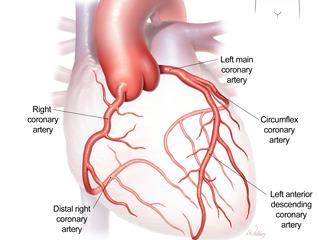 Espectro clínico da doença coronária Doença arterial coronária Doença coronária Estável Síndromes Coronárias
