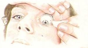 lavar olho -água corrente (ou soro) para lavar o olho, mantenha-o aberto com a ajuda do dedo
