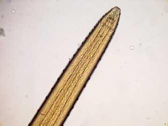 (1998) e Eiras et al. (1994), para a coleta dos parasitos. A identificação é feita através de chaves de Yamaguti (1961), e Travassos (1937).