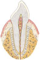 Sindesmose Gonfose entre o dente e o alvéolo Corte longitudinal do dente molar ( vista lateral) Corte