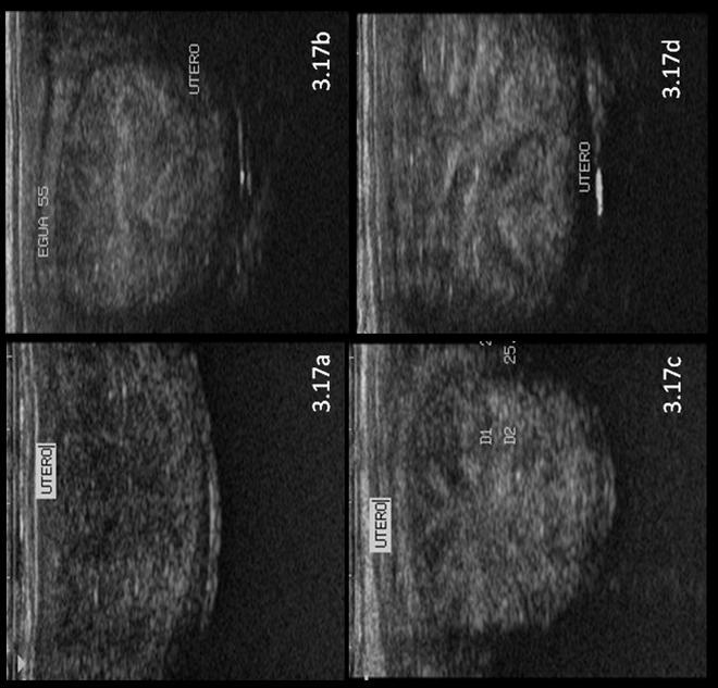 Fonte: Arquivo pessoal 3.17. a) Imagem ultrassonográfica do útero com ausência de edema uterino intramural.