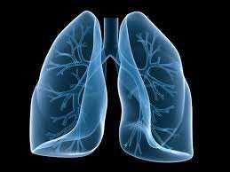 Complicações Pulmonares São complicações graves que afetam principalmente pacientes idosos ou