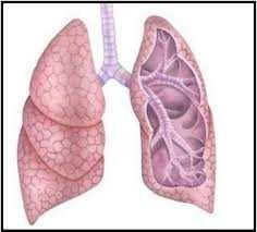 Complicações Pulmonares Causas: Irritação das mucosas por anestésicos inalados que provocam aumento de