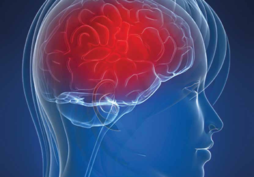 c nmo b Pensamento positivo é crucial durante tratamento de Neuromielite Óptica Apesar de não ter cura, terapêuticas garantem melhor qualidade de vida.