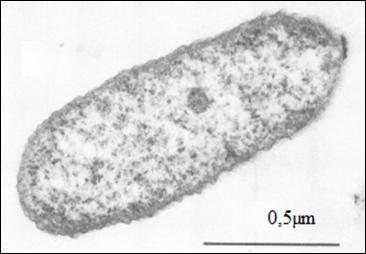 42 Acidithiobacillus acidophilus: Células no formato de bacilos, com largura de 0,5 até 0,8 μm de largura e 1,0 até 1,5 μm de comprimento, aeróbias, mesofílicas com temperatura ótima entre 27 e 30ºC.