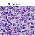 o Problemas articulares e cardíacos. o Gênero Bacillus spp.