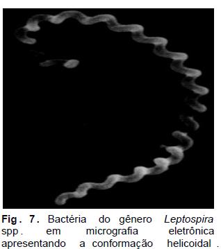 Espiroquetas e microrganismos espiralados o Leptospira sp.
