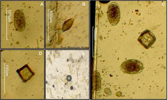 16 Cooperia punctata, Strongyloides papillosus e Nematodirus spp. No intestino grosso são comuns às espécies de Oesophagostomum radiatum e Trichuris discolor.