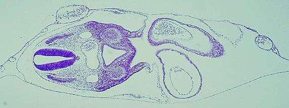 bulbo ventricular. Perceba que essa parte do coração primitivo está presa à parede corporal pelo mesocárdio dorsal. Identificar as aortas dorsais.