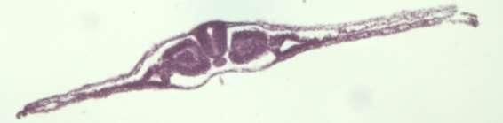 g. Identificar a medula espinhal e o canal central da medula, os somitos (RA), o