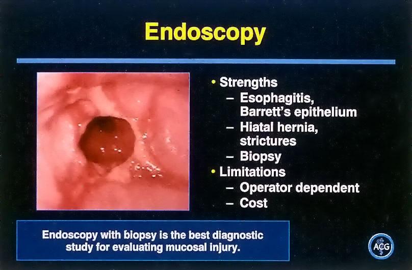 Endoscopia Indicações para endoscopia Sintomas de alarme
