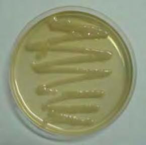 37 A B Figura 01: Imagens das placas utilizadas para cultura e antibiograma, sendo A crescimento bacteriano de uma amostra semeada em meio de ágar Mac Conkey e B teste de antibiograma através da