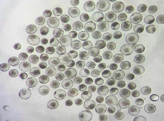 In vitro PIVE Aspiração folicular MIV FIV 18h CIV D8 Blastocisto (D8) Contagem celular