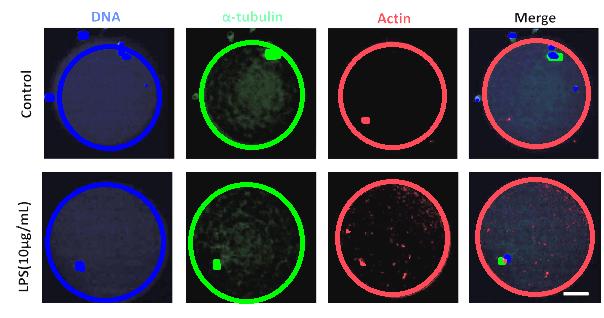 Controle Ciclo celular (22h) Actina: phalloidin-tritc Observações na montagem da Actina de