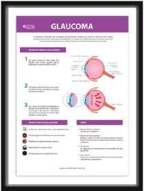 MM-574H Poster Glaucoma Poster informativo para lojas e consultórios sobre o