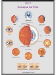 MM-574J Doenças do Olho Poster informativo para lojas e