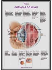 Doenças do Olho II Poster informativo com moldura para