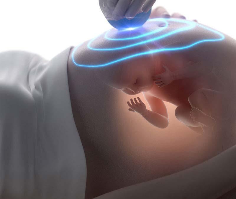 Ultrassom É recomendado fazer pelo menos 3 ultrassom: 1ª - no primeiro trimestre: se têm bebê, quantidades, localização, idade gestacional.