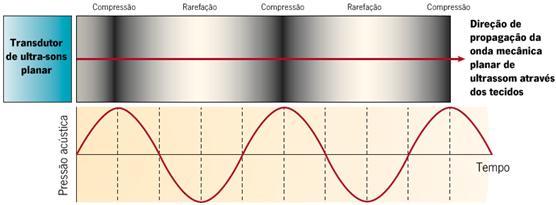 Ultrassom focalizado de alta intensidade O termo ultrassom refere-se às vibrações mecânicas acima do limiar da audição humana (16 khz).