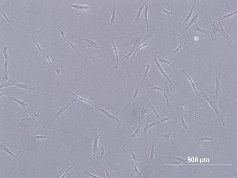 30 5. RESULTADOS 5.1. Análise morfológica As células estromais mesenquimais derivadas da derme abdominal humana foram cultivadas e fotomicrografadas em microscópio invertido de contraste de fase.