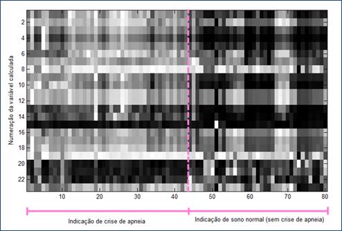 crise de apneia Redução de dimensionalidade: PCA 4