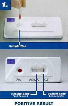 Imunocromatografia