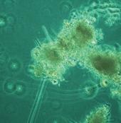 Flocos microbianos ou Bioflocos O que