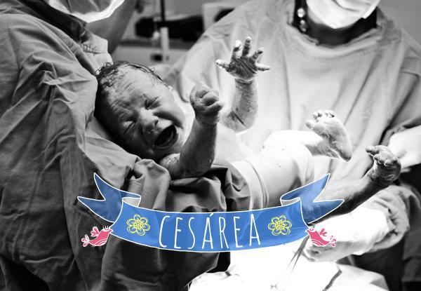 PARTO CESÁREA Cesareana também denominada cesárea é uma técnica técnica utilizada para retirar um feto de dentro do útero; Procedimento é realizado no CC seguindo todas as técnicas assépticas e de