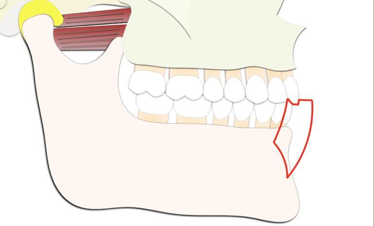 32 Os movimentos mais extremos realizados pela mandíbula são chamados de bordejantes, sendo limitados pelas estruturas anatômicas, formando o envelope de movimentos de Posselt.