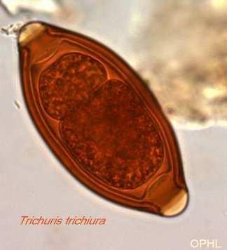 Trichuris