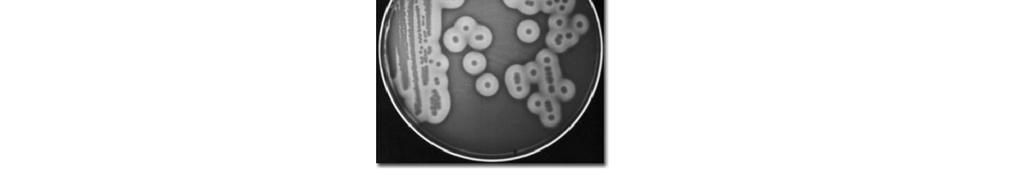 Meios de Cultivo Diferencial Utilizado para a fácil identificação da colônia da bactéria de interesse quando existem outras bactérias crescendo na mesma placa