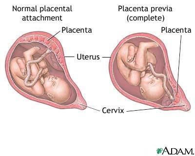 Lateral: a