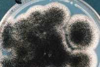 de Farmácia e Bioquímica da UFMS: Microbiologia Clínica Quando Valorizar o Isolamento de Fungos em Cultura?