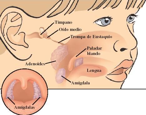 Alterações Morfofuncionais Dentes: hipoplásicos,