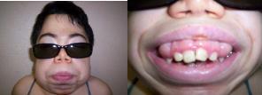 Sistema Estomatognático Sucção, Mastigação e Deglutição Alterações em lábios, língua, bochechas, mandíbula, palato duro e arcada