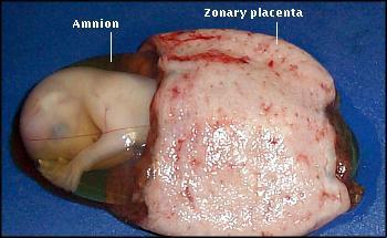 MATERNO-FETAL