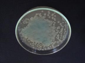 Ilustração da inoculação da amostra de sêmen em placa de Petri. 2.
