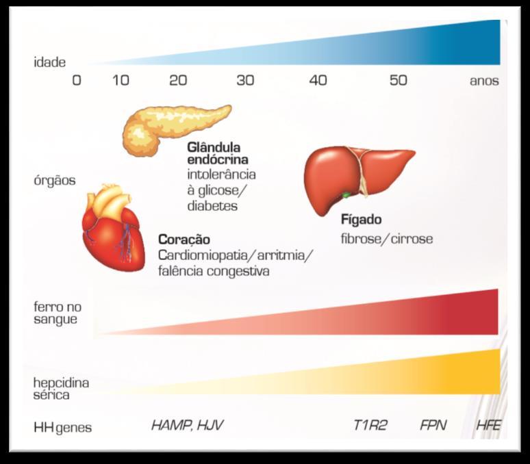 23 Figura 5 - Evolução da Hemocromatose Hereditária (HH). Nas formas mais graves de HH, o acúmulo de ferro no sangue é precoce, e resultado de mutações em outros genes, como o HAMP, HJV, TfR2 e FPN.