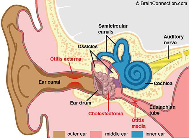 PRINCIPAIS CAUSAS DA PERDA DE FUNÇÃO AUDITIVA SONS INTENSOS (acima de 120dB) Rompimento do tímpano, lesões ossiculares e da membrana basilar